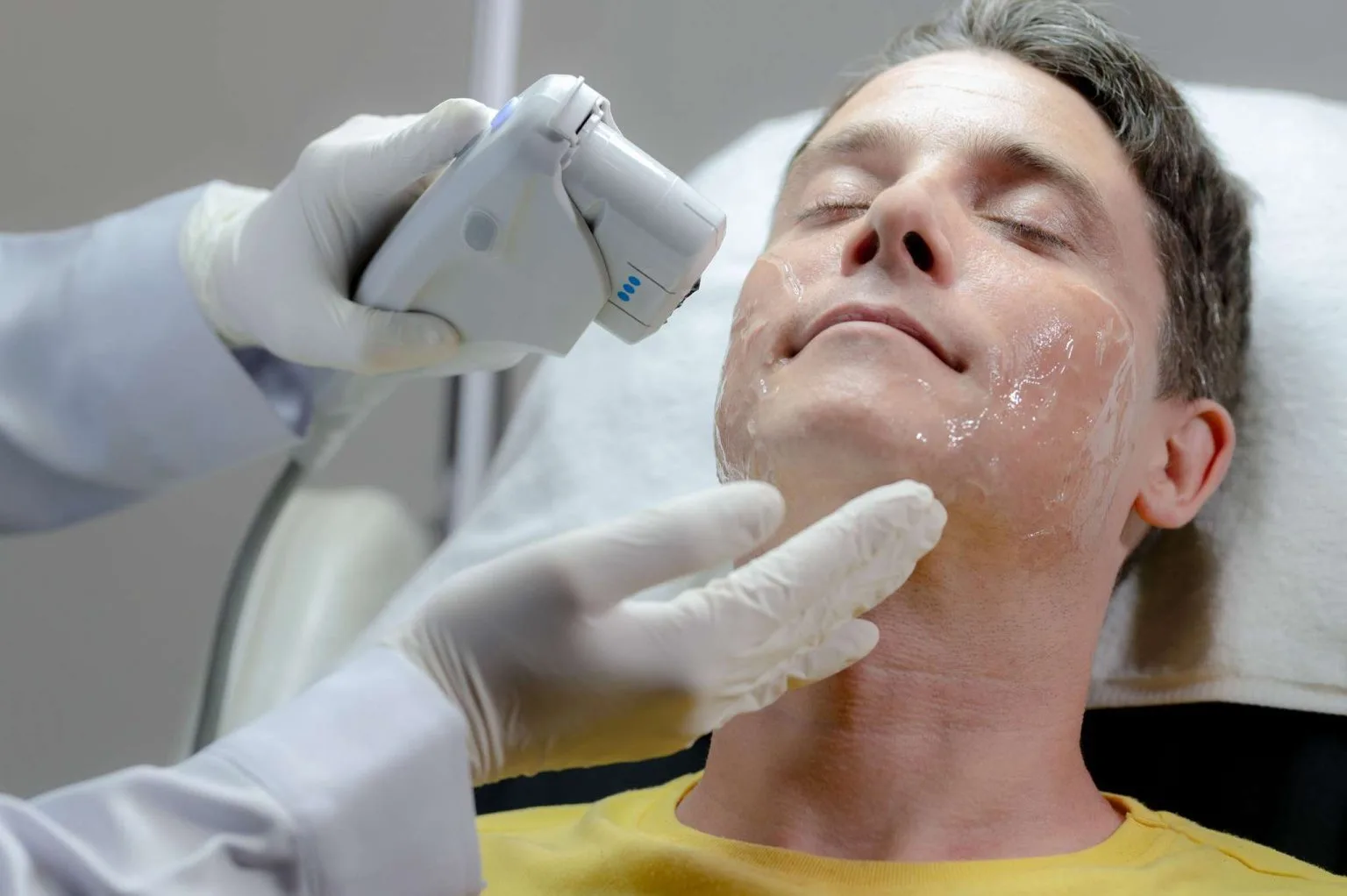 a white man gets a laser facial by a specialist 2022 09 21 19 42 23 utc 2048x1362 1 1536x1022 1