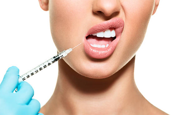 Botox Lip Flip treatment in Chelsea and Battersea