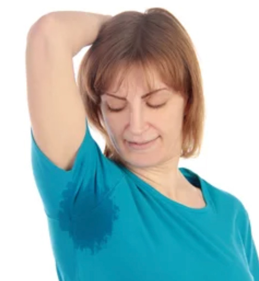 Lady sweating with Hyperhydrosis in Chelsea and Battersea